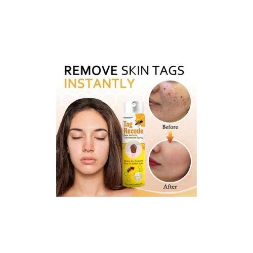 ee Venom Skin Tag Removal Spray, Tag Recede Bee Venom Spray, Bee Venom Wart and Tags Removal Treatment Spray 600ML each